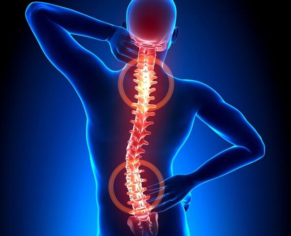болка в гръбначния стълб с остеохондроза