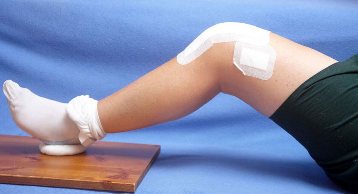 нараняване на коляното като причина за артроза